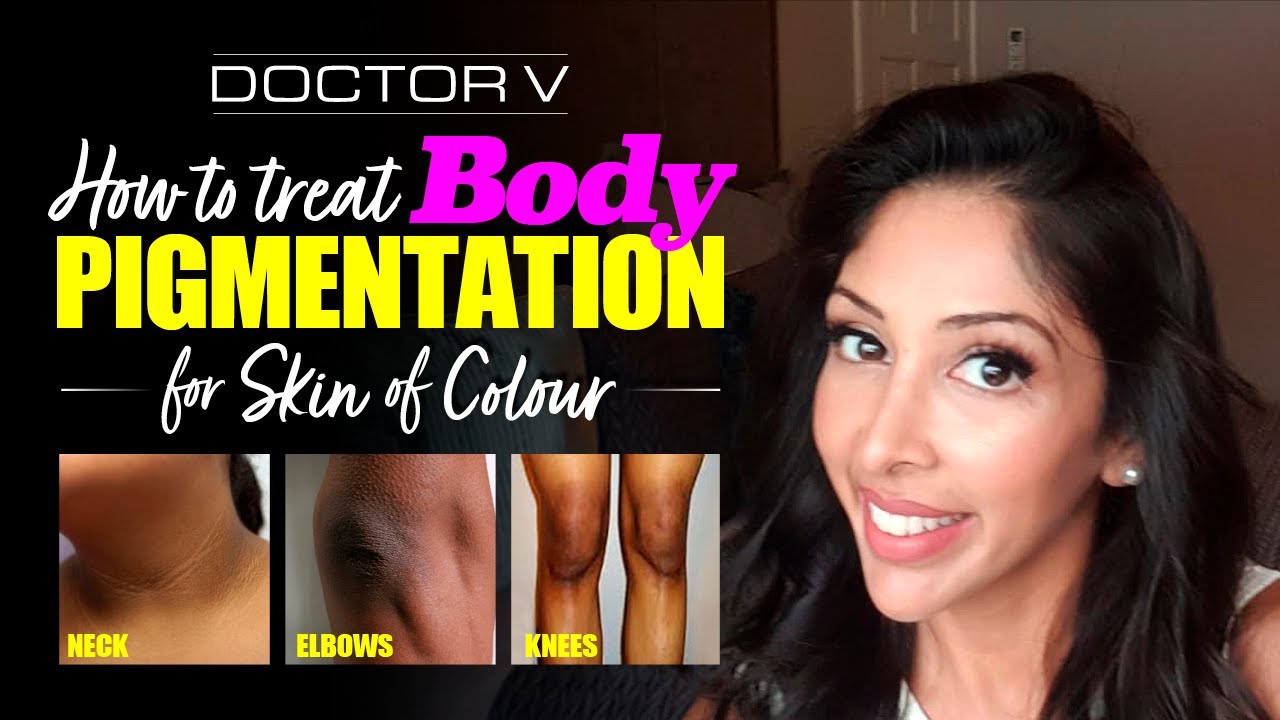 Doctor V - How To Treat Body Pigmentation For Skin Of Colour | Brown Or Black Skin |