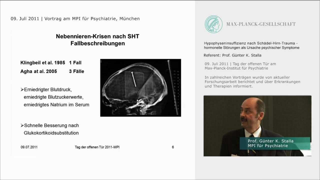 Psychische Störungen nach Schädel-Hirn-Trauma
