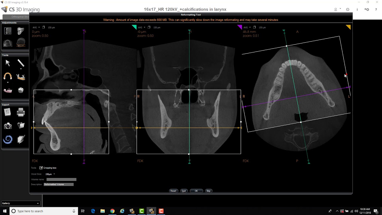 CS 3D Imaging - Reformatting Tool