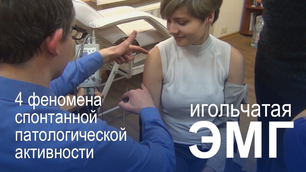 Игольчатая электромиография (ЭМГ). Феномены спонтанной патологической активности