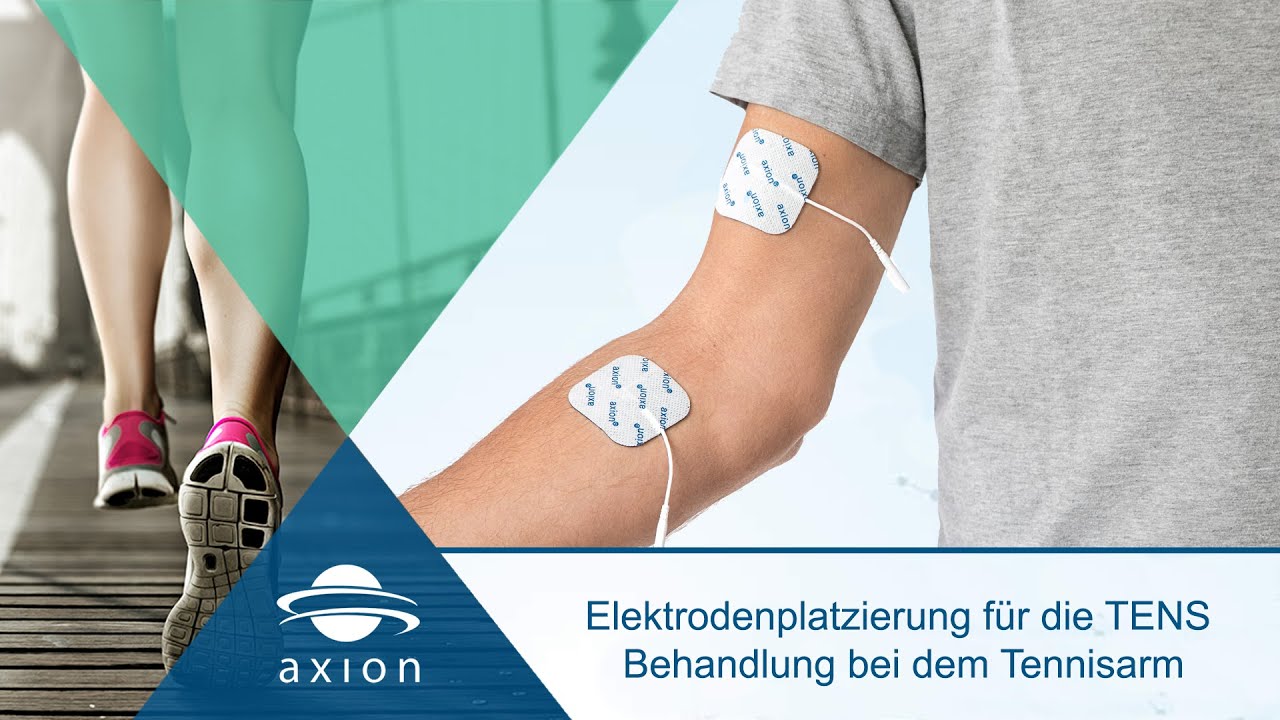 Tennisarm - Elektrodenplatzierung f&uuml;r TENS | axion