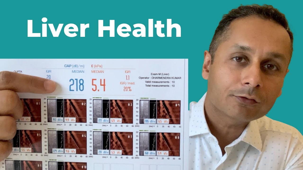 Fatty Liver | Non-alcoholic Fatty Liver Disease | How to Reverse | Fasting | Keto
