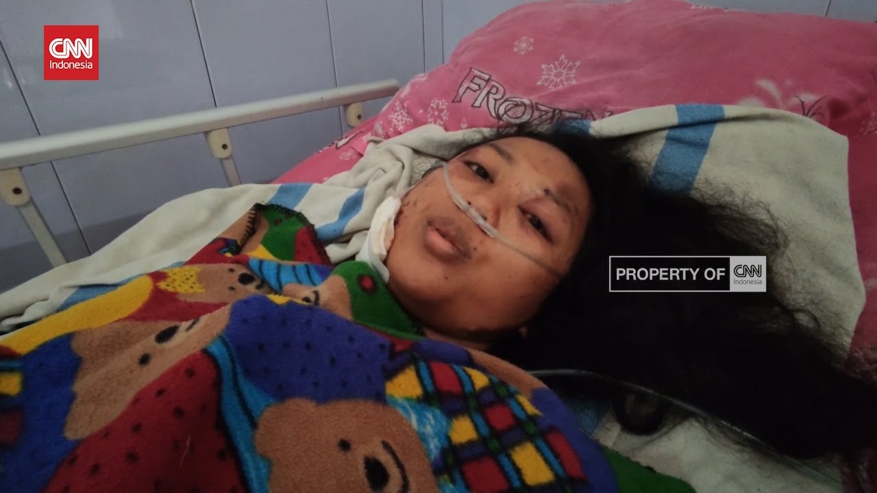 Penuturan Korban Selamat Tabrakan Purworejo