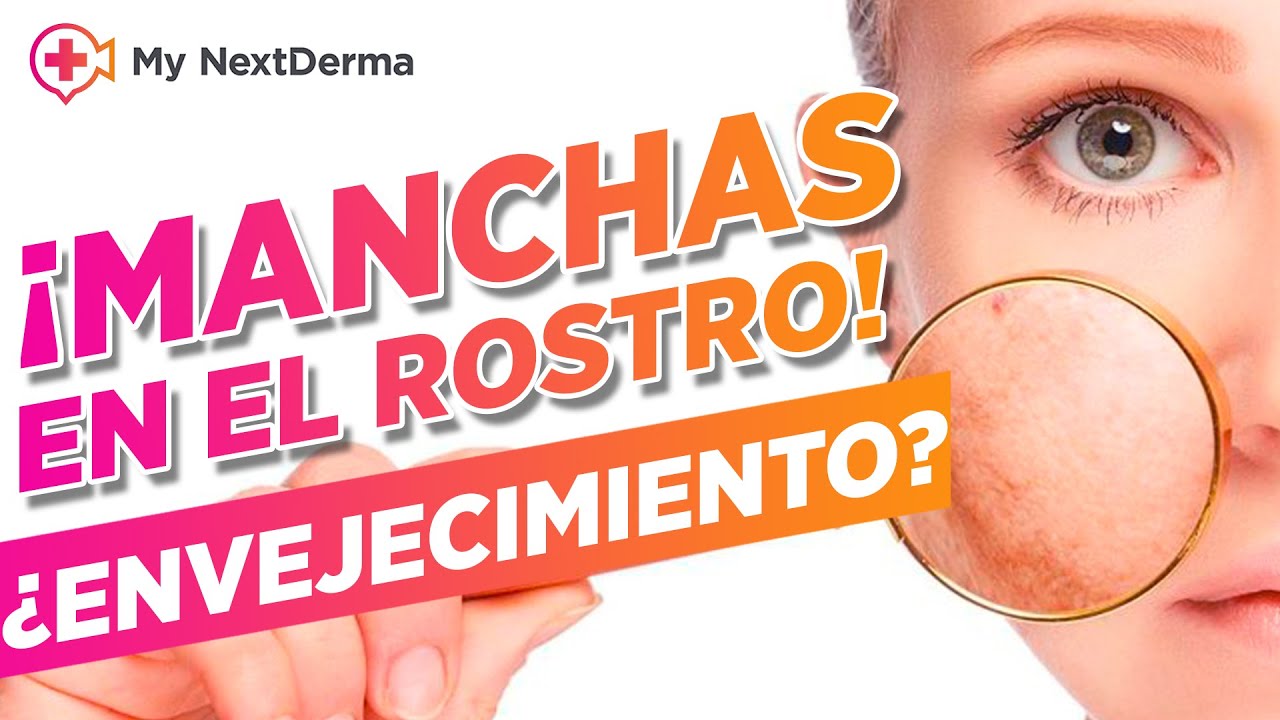 ¡MANCHAS EN TU PIEL! ¿Son signos de la edad? / Dermatólogo te Recomienda