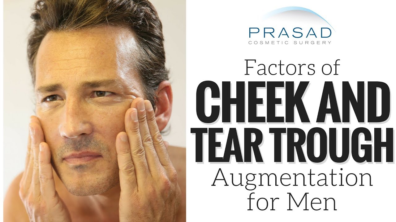 How Cheek Augmentation is Done Differently for Men, and the Advantages of Newer Cosmetic Fillers