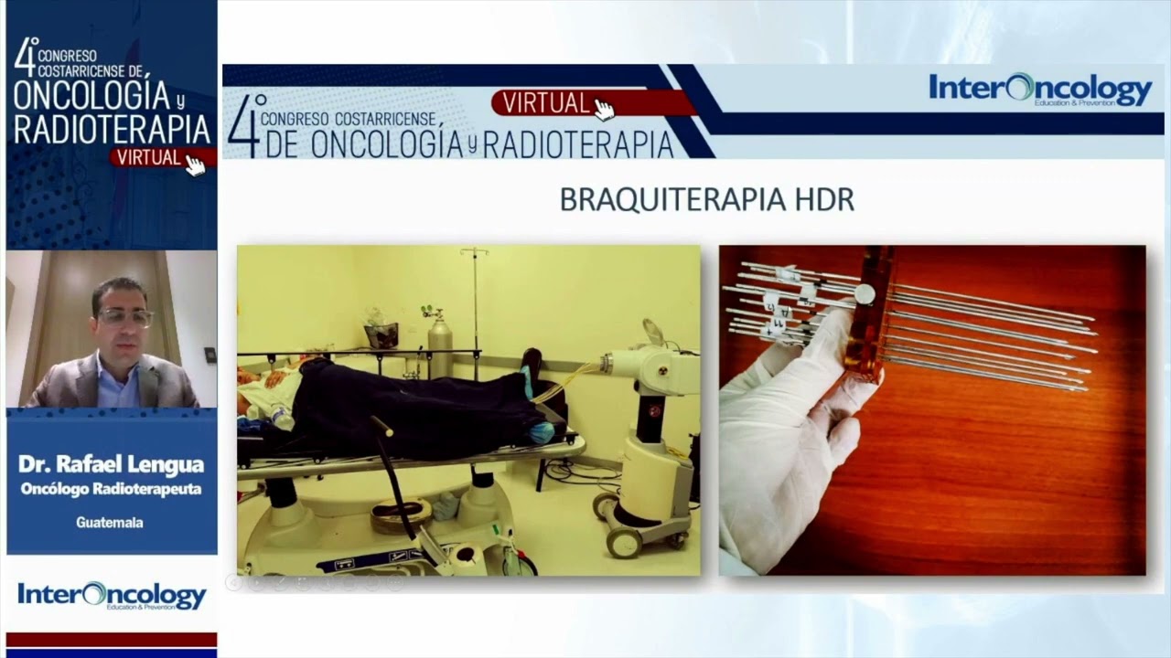 Braquiterapia en Cáncer de Próstata