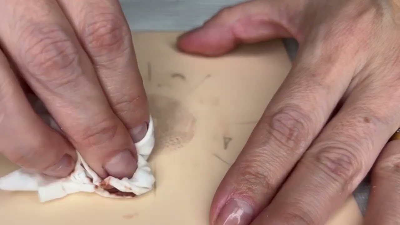 Aula 5 - Micropigmentação Paramédica de Areolas