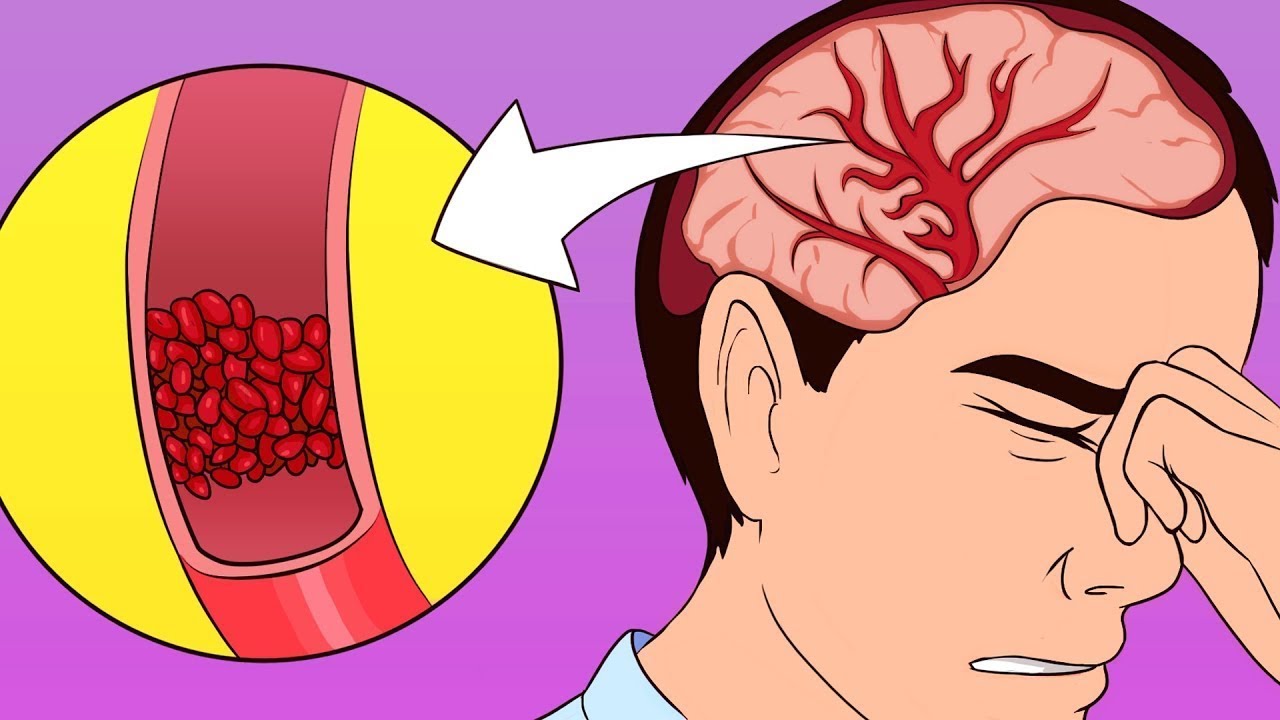 🤕 Cura il Mal di testa: 3 sistemi scientificamente provati 🔬