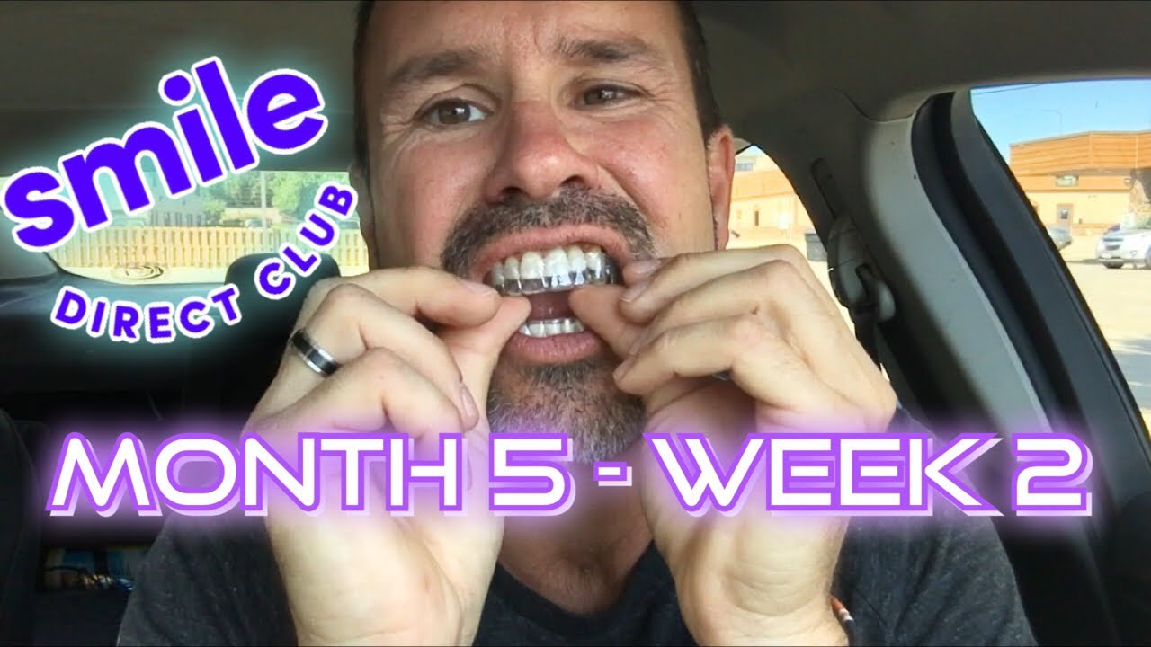 SmileDirectClub - Month 5 - Week 2 update (promo code)