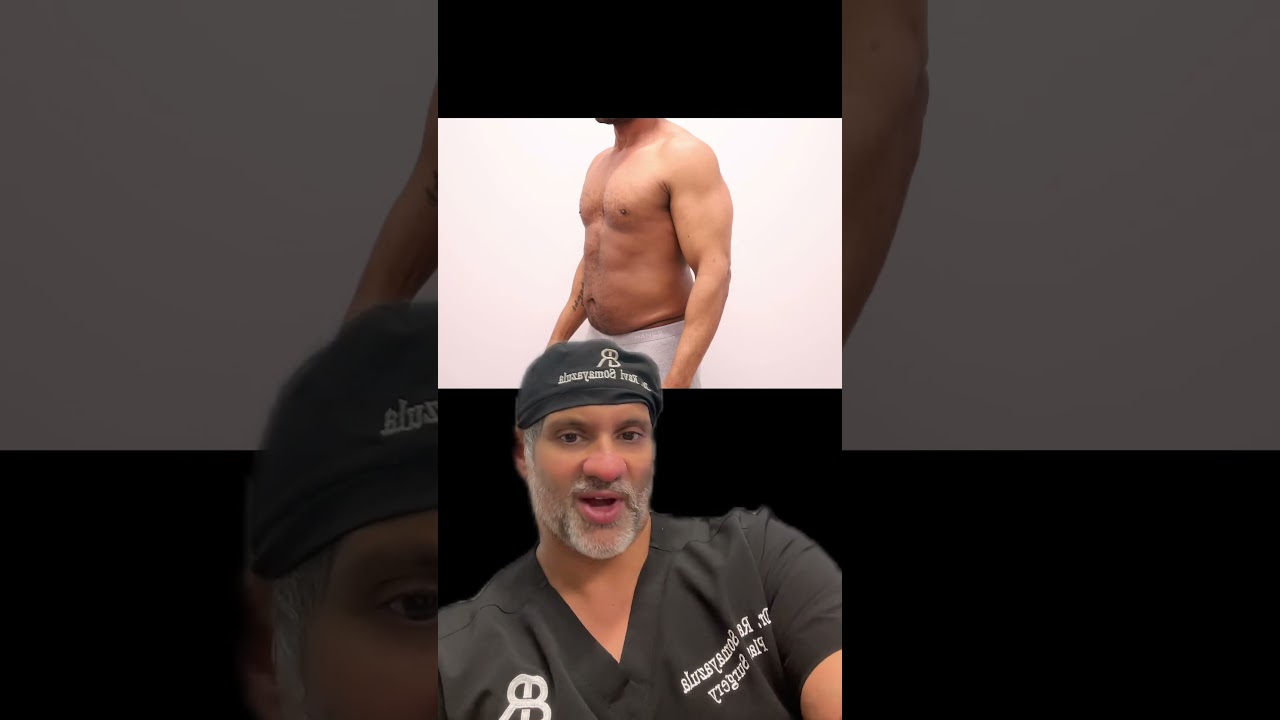 Follow along with this incredible body lift journey 👏🙌 