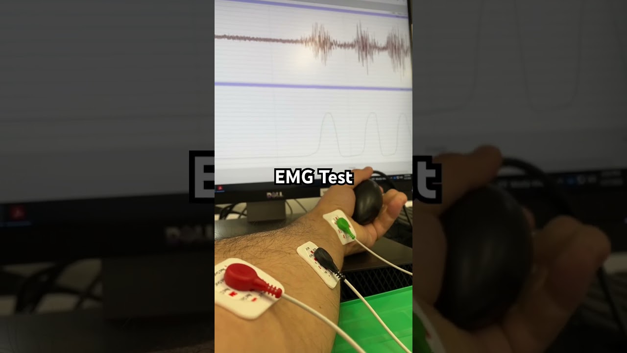 EMG: Measuring Muscle Activity and Grip Strength with the iWorx Data Acquisition System