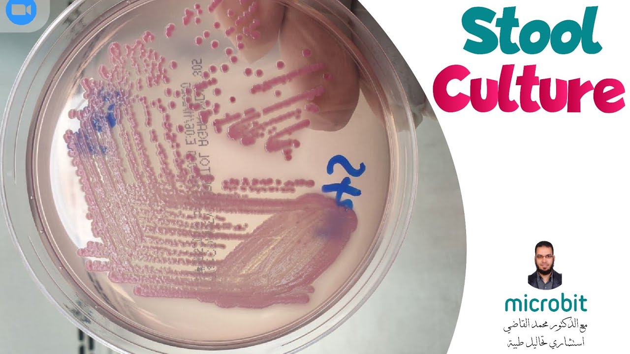 GIT Stool culture 01