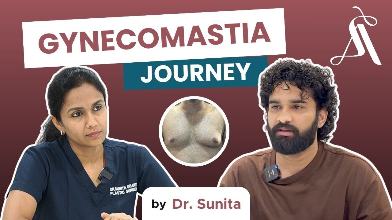 Best Gynecomastia Surgeon in Visakhapatnam | Before & After Surgery with Dr. Sunita Ghanta