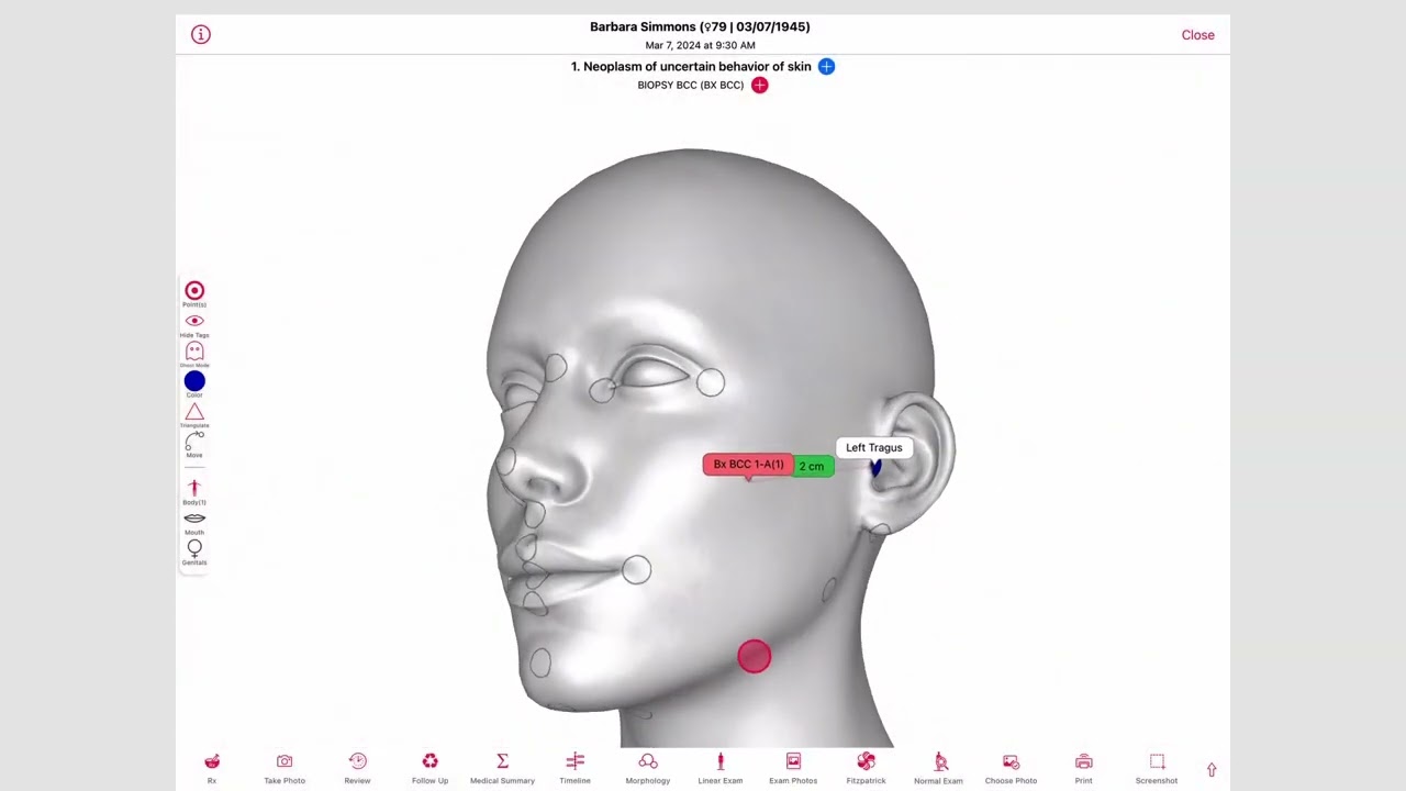 Welcome to Ezderm: The Only Full-Suite EHR & PM Made Exclusively for Dermatologists