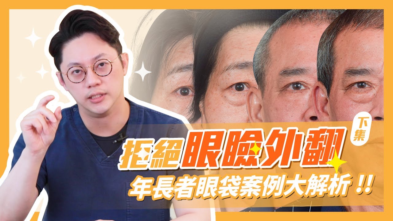 拒絕眼瞼外翻！年長者眼袋案例大解析(下集)｜周杰醫師