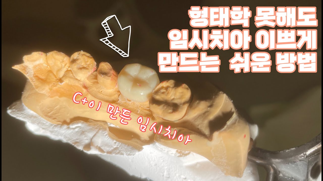 형태학 못해도 임시치아 이쁘게 만드는 쉬운방법