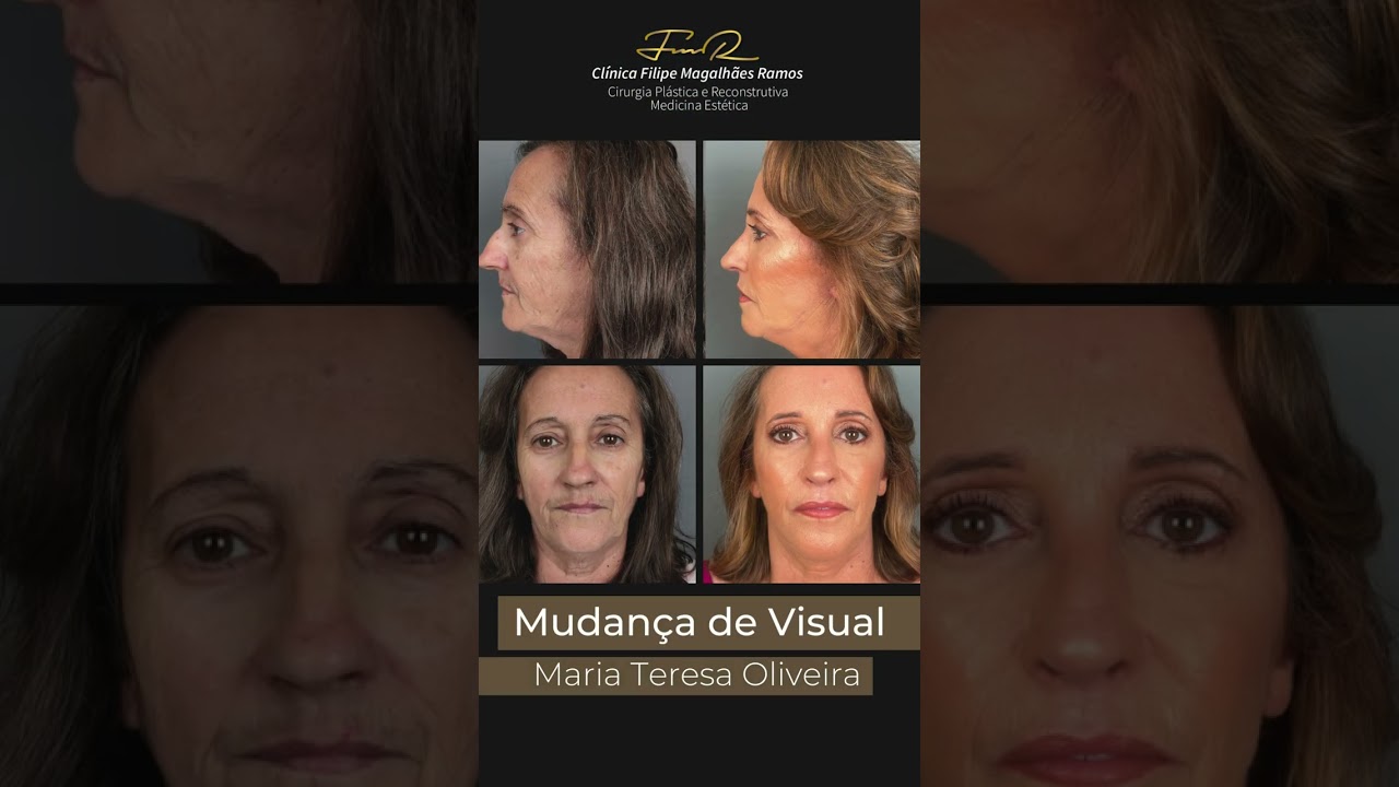 Mudança de Visual Casa Feliz SIC | Clínica FMR -  Dr. Filipe Magalhães Ramos