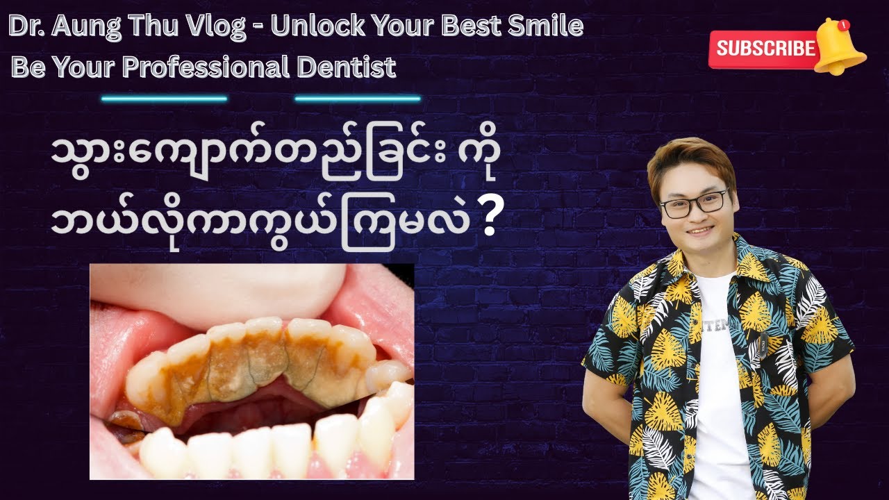 သွားကျောက်တည်ခြင်းကိုဘယ်လိုကာကွယ်ကြမလဲ ?
