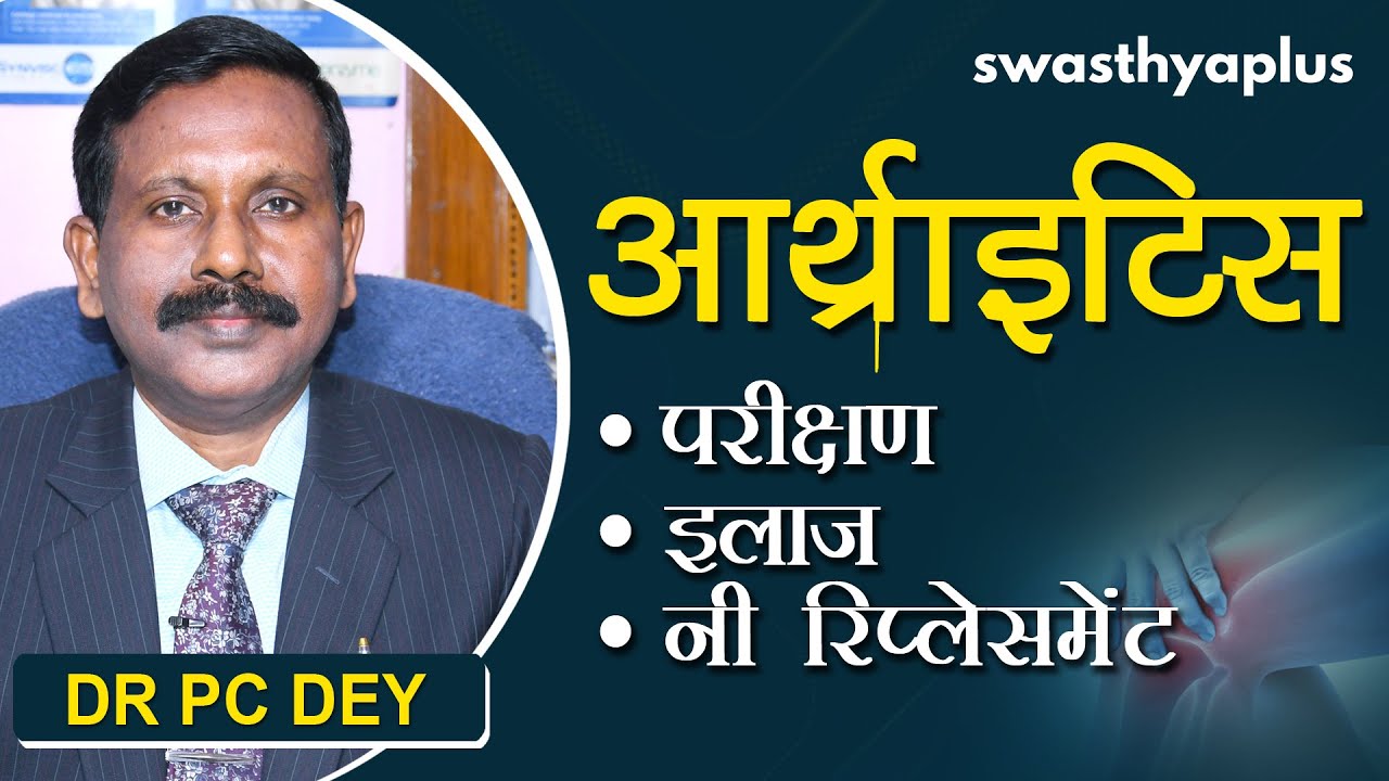 आर्थराइटिस (गठिया) - परीक्षण, इलाज और नी रिप्लेसमेंट | Dr PC Dey on Arthritis in Hindi | Treatment