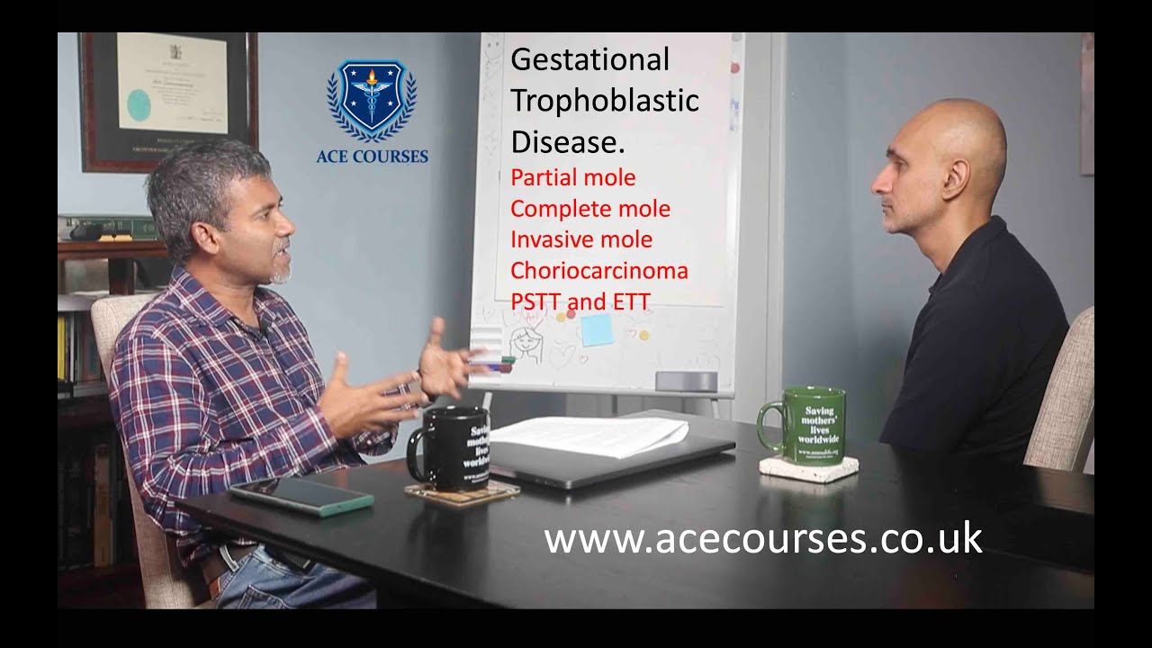 Gestational Trophoblastic Disease (GTD). Molar pregnancy. Hydatidiform mole. RCOG guideline. MRCOG.