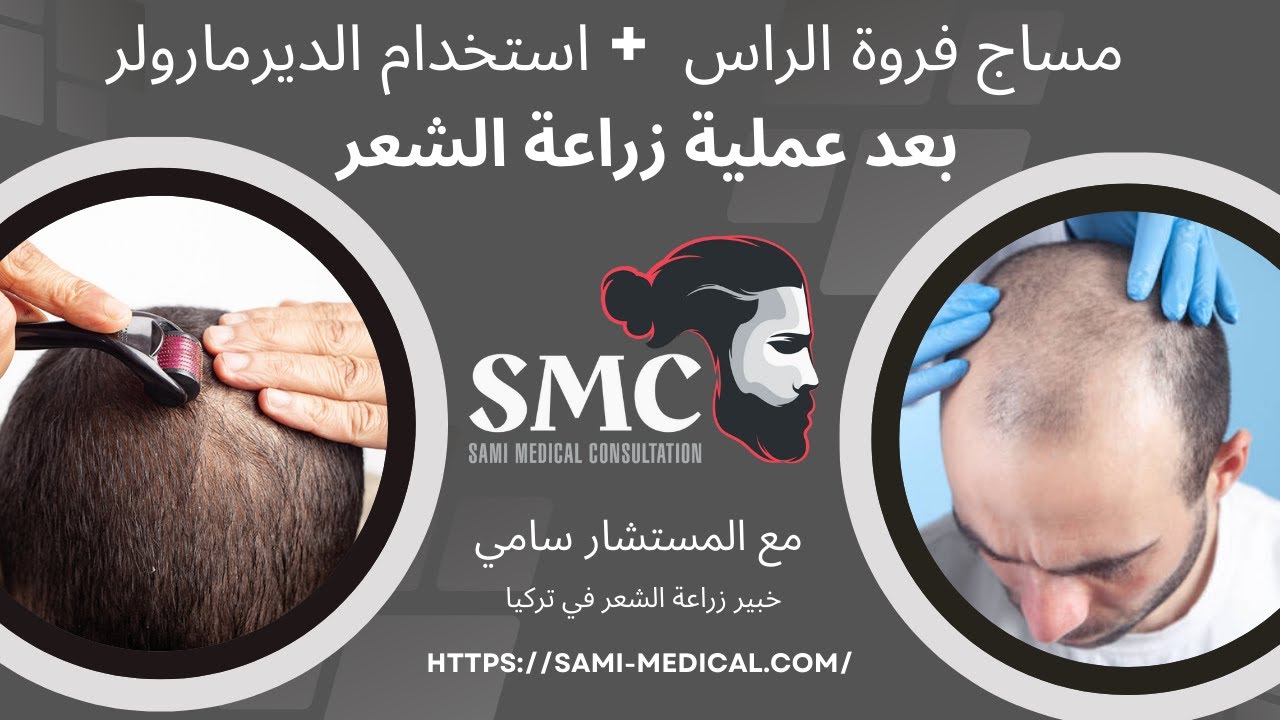 مساج فروة الراس واستخدام الديرمارولر بعد زراعة الشعر