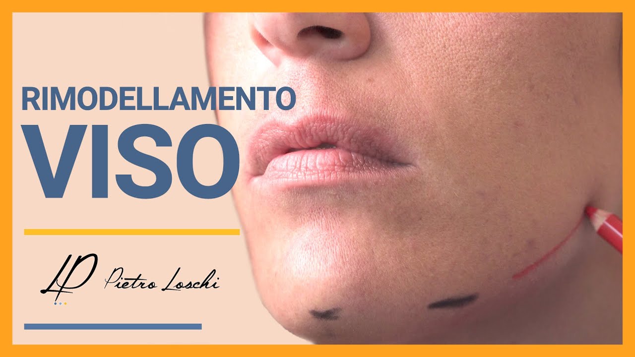 Medicina Estetica: RIMODELLAMENTO VISO e ANTIAGE - Chirurgo Plastico Modena Bologna Milano