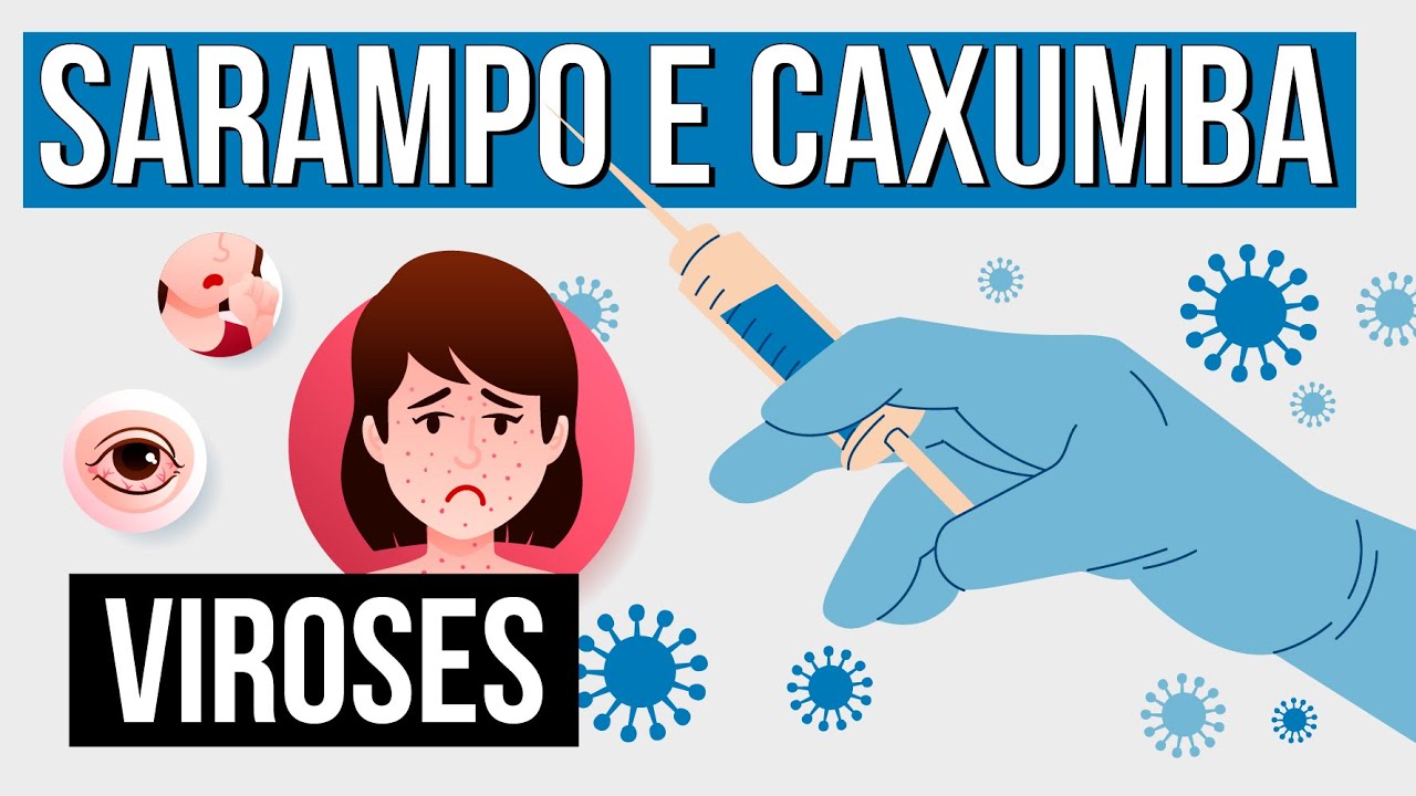 SARAMPO E CAXUMBA: tipos de viroses | Resumo de Biologia para o Enem | Cl&aacute;udia de Souza Aguiar