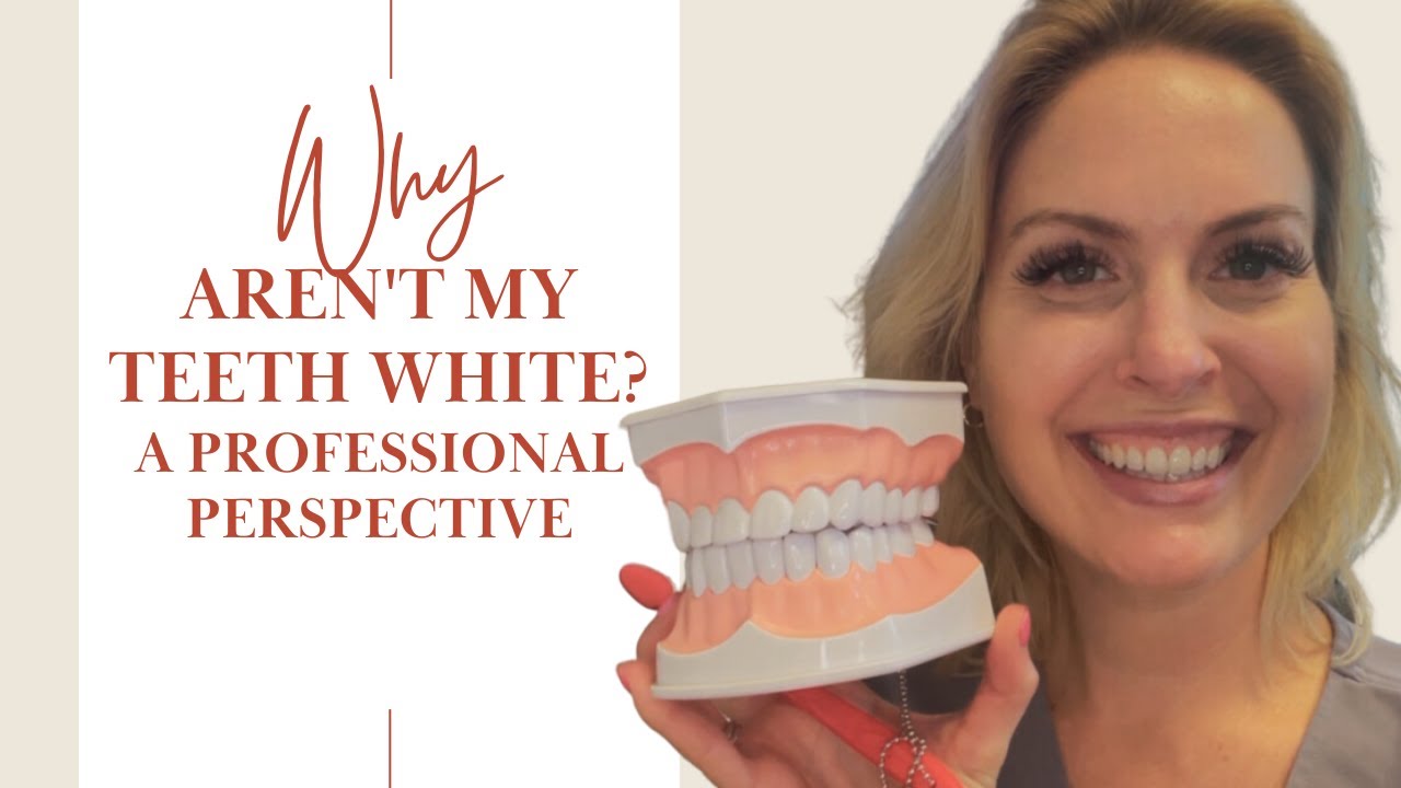 REASONS WHY YOUR TEETH AREN'T WHITE | A PROFESSIONAL PERSPECTIVE