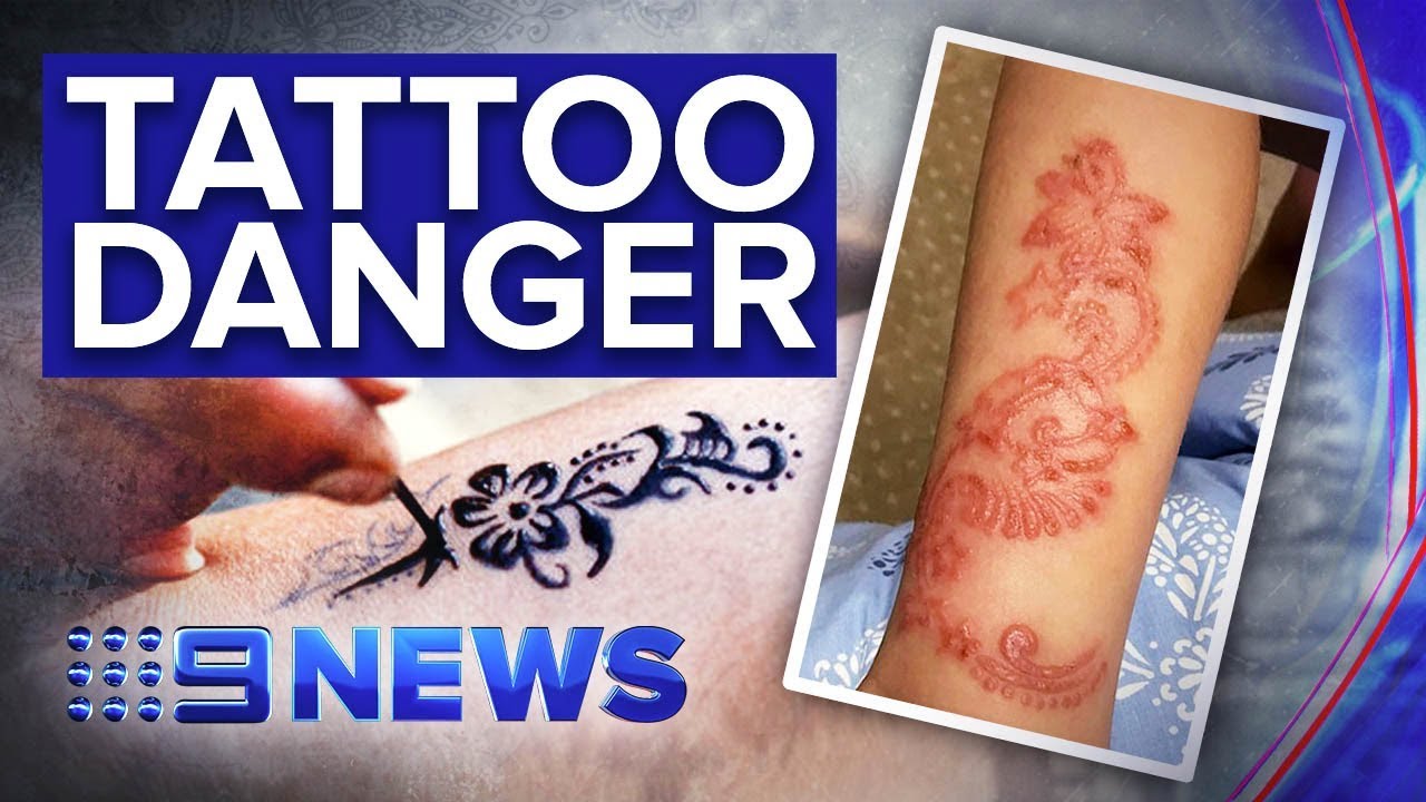 'Black henna' leaving Bali tourists with scars | Nine News Australia