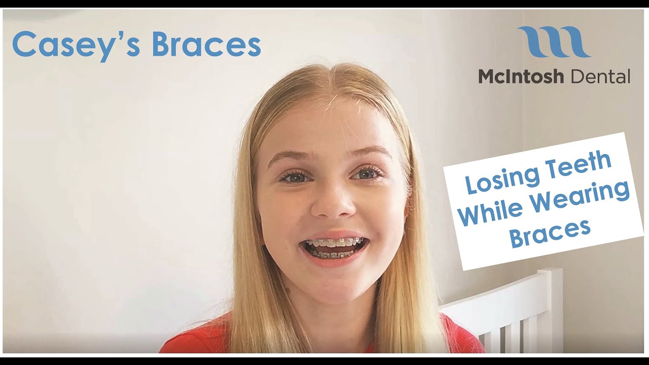 Casey's Braces: Losing Teeth While Wearing Braces