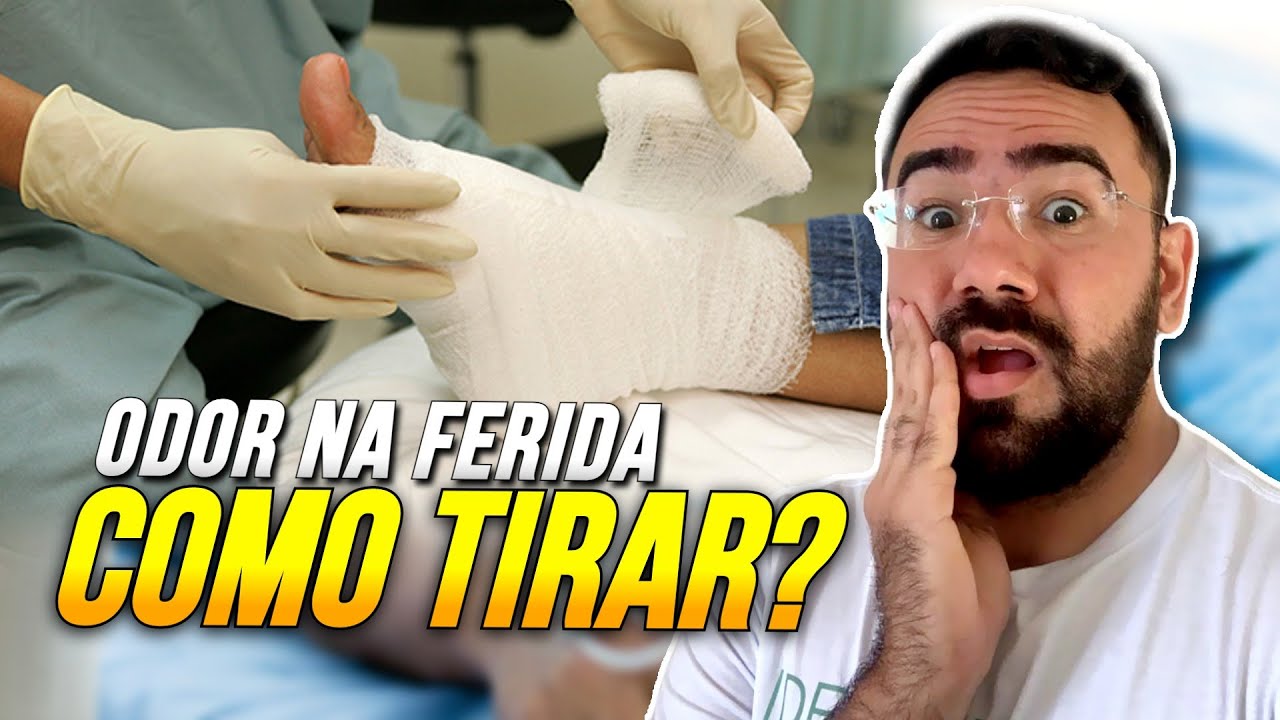 FERIDA EST&Aacute; FEDENDO! O QUE FAZER? COMO REMOVER ODOR NA FERIDA?