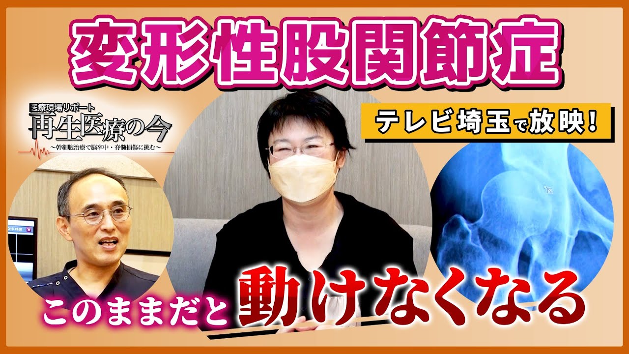 【変形性股関節症・再生医療】テレビ埼玉『医療の現場リポート・再生医療の今』で放映！変形性股関節症患者様の症例紹介です！