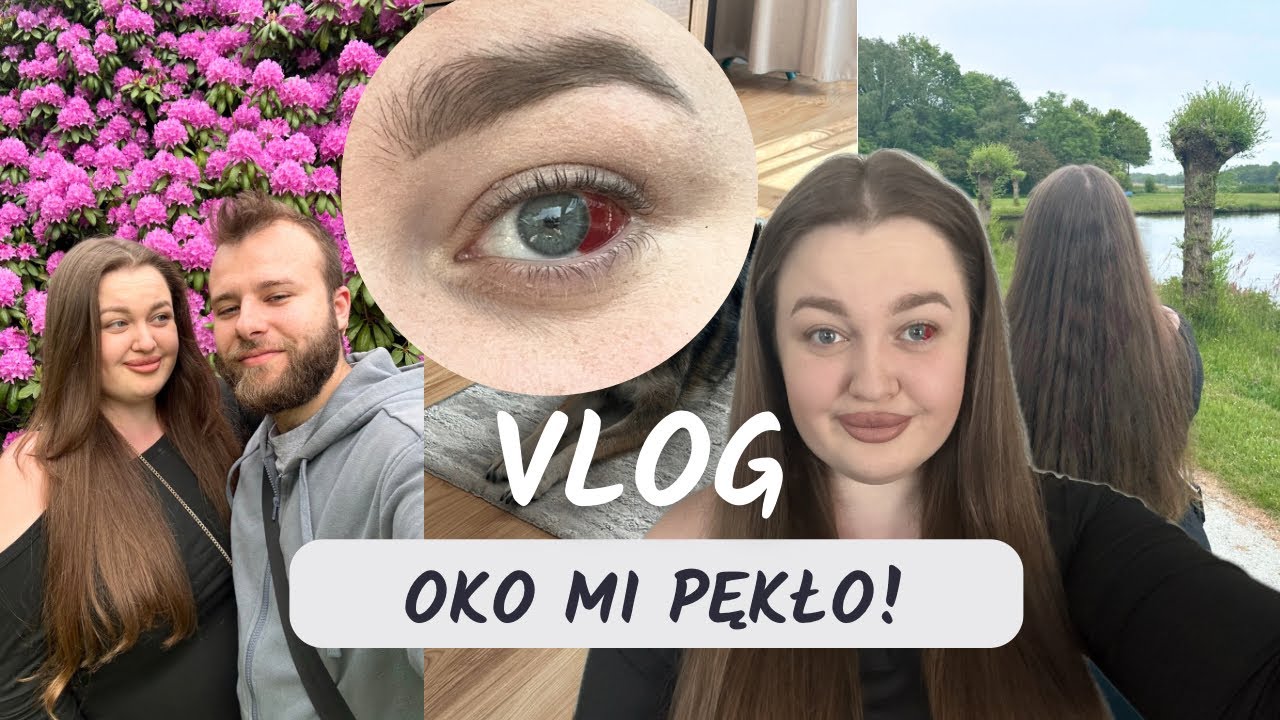 VLOG: WYLEW W OKU!🤯 | JAK WYGLĄDA HOLENDERSKI SZPITAL?
