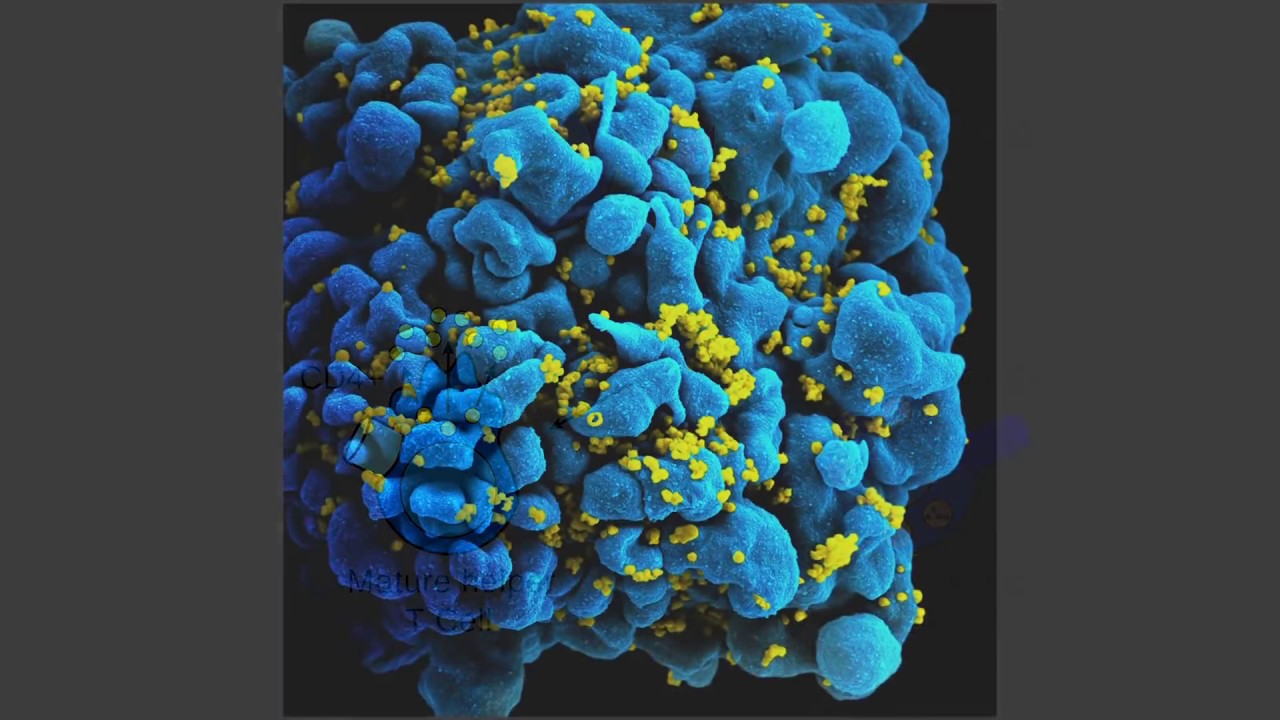 Italics: Dr. Robert Gallo on HIV-AIDS / Photographer Alexo Wandael