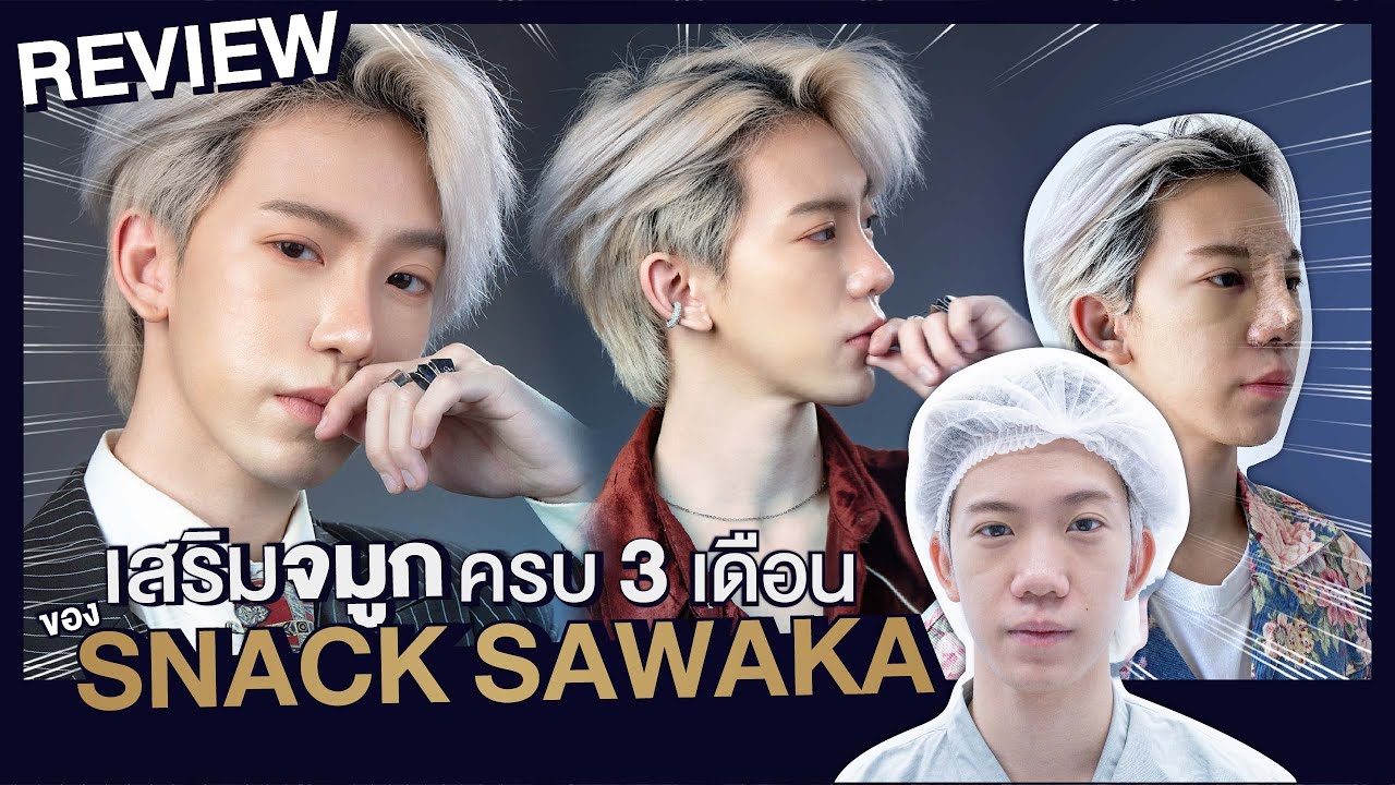รีวิวเสริมจมูกผู้ชายกับ snack sawaka ผลลัพธ์3เดือนจากจมูกชมพู่เรียวพุ่งเป็นoppa ที่someko