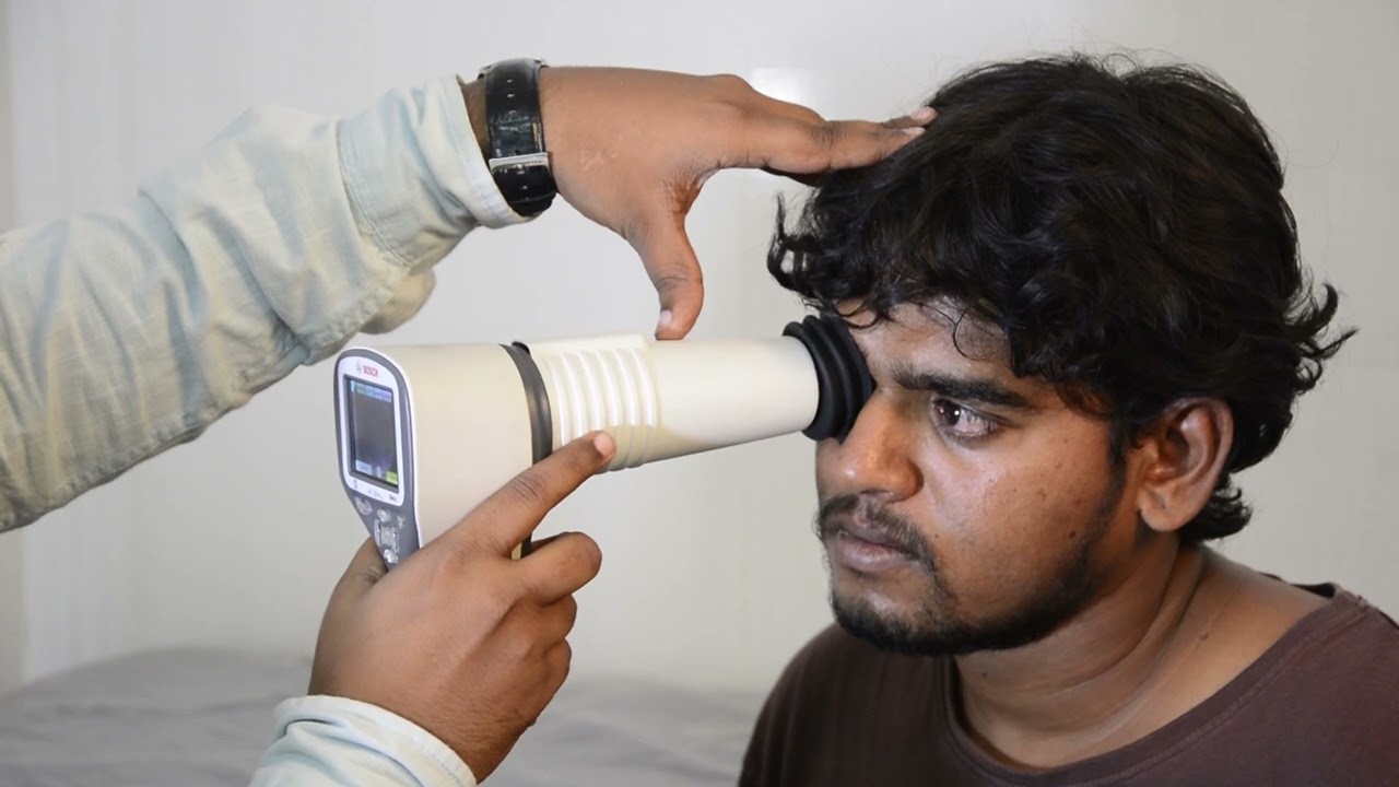 Fundus Camera Demo | BOSCH Fundus Camera Demo