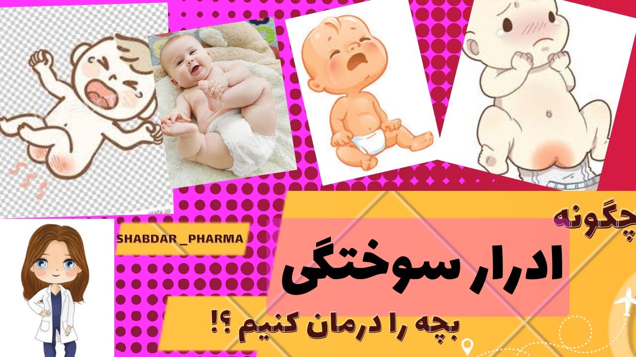 درمان ادرار سوختگی نوزاد _ چگونه از ادرار سوختگی کودکمان جلوگیری کنیم _ استفاده از کرم ادرار سوختگی