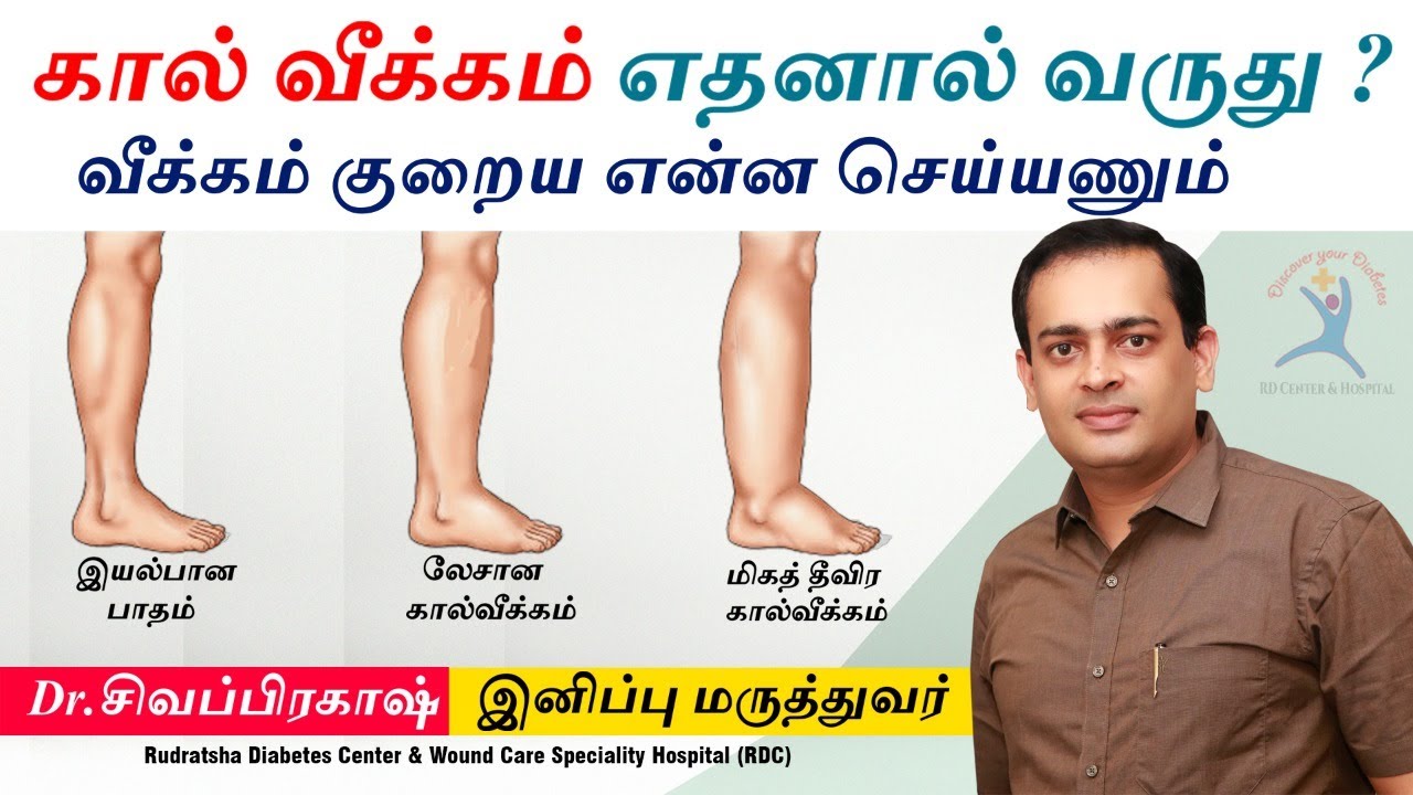 கால் வீக்கம் எதனால் வருகிறது? கால் வீக்கம் குறைய என்ன செய்யணும்? | Dr Sivaprakash