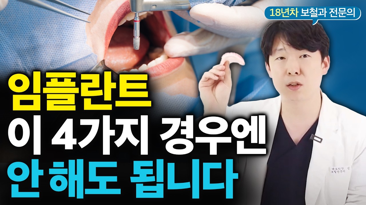 “돈만 날립니다” 임플란트 굳이 안 해도 되는 4가지 유형