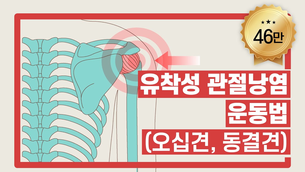 오십견(유착성 관절낭염) 운동법 | 서울성모병원
