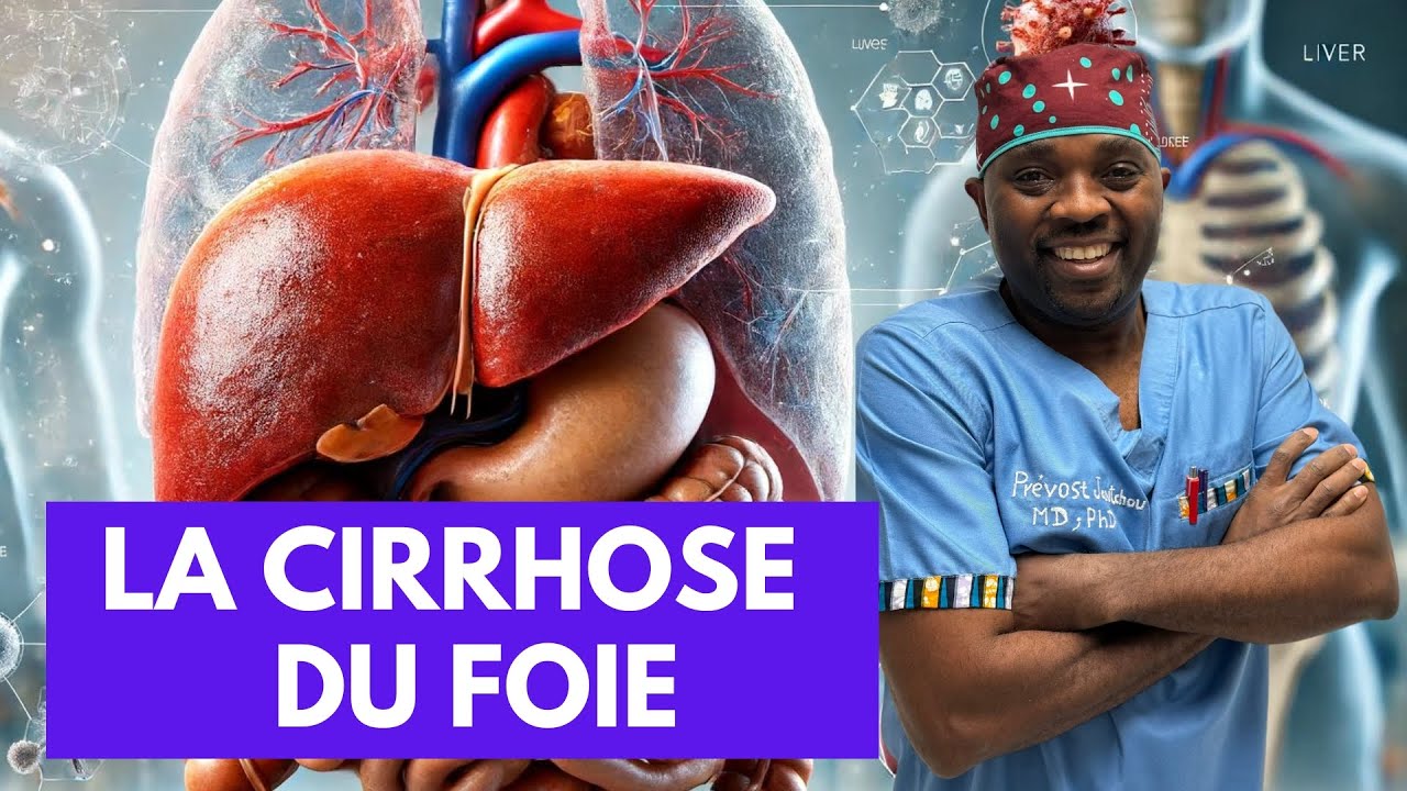 Tout savoir sur La cirrhose du foie par @Docteur Sourire