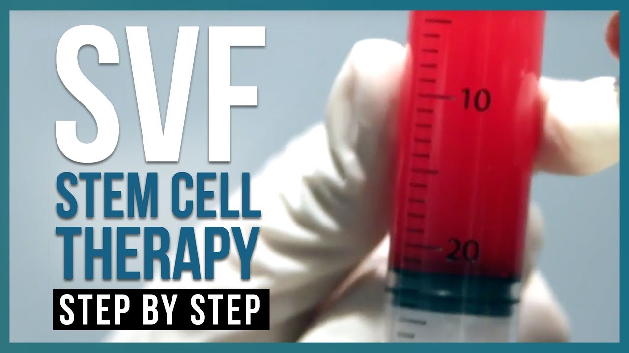 Stromal Vascular Fraction Stem Cell Therapy (SVF Therapy) | Step-by-Step