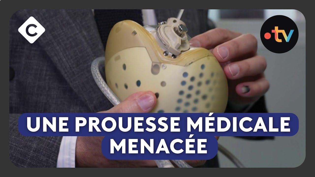 Carmat : le c&oelig;ur artificiel fran&ccedil;ais &agrave; bout de souffle ?