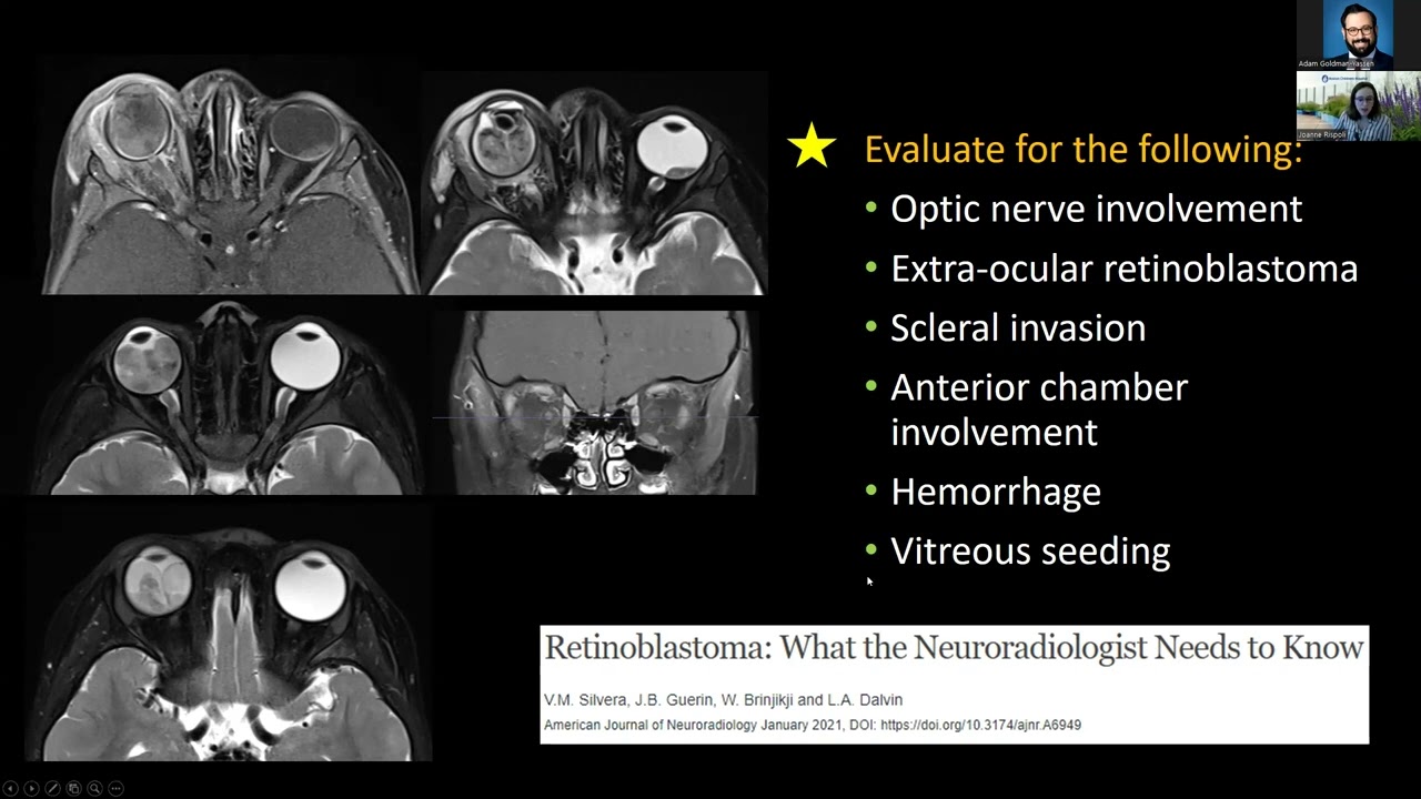 Orbital Pathology  --  Dr. Joanne Rispoli -- 10.19.2023