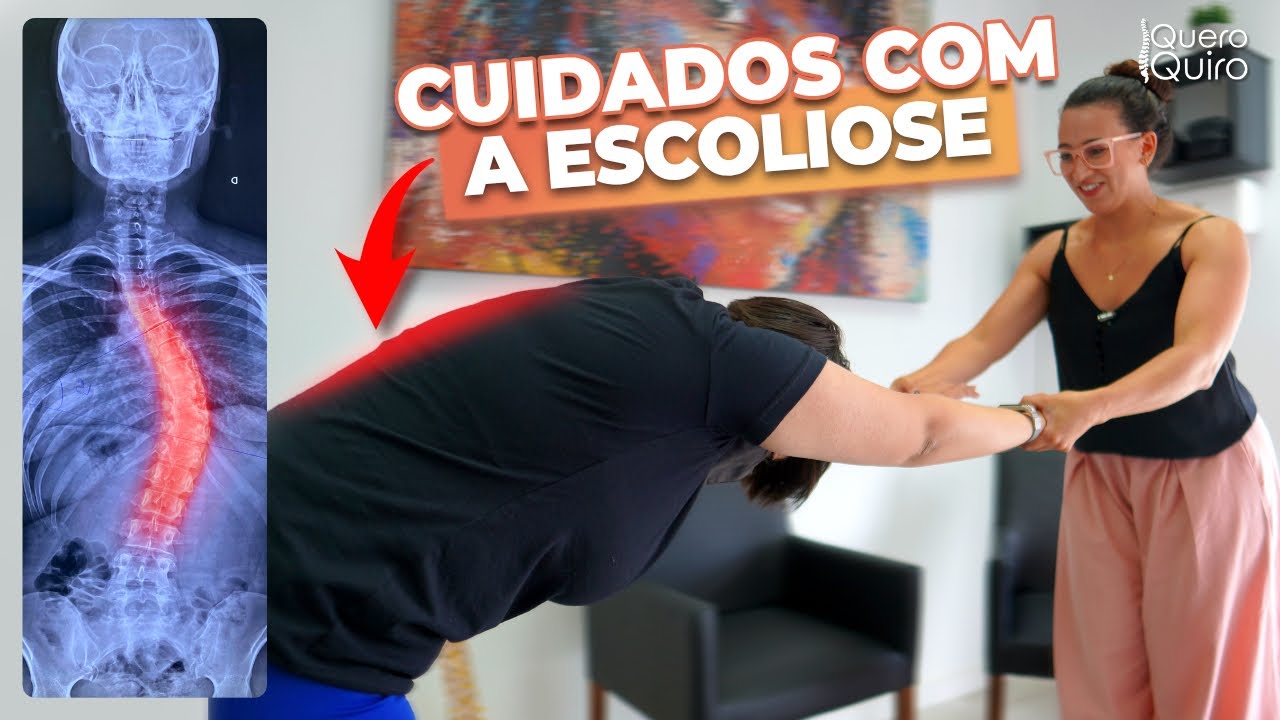 COMO SERIA UMA SESSÃO DE QUIROPRAXIA PRA QUEM TEM ESCOLIOSE