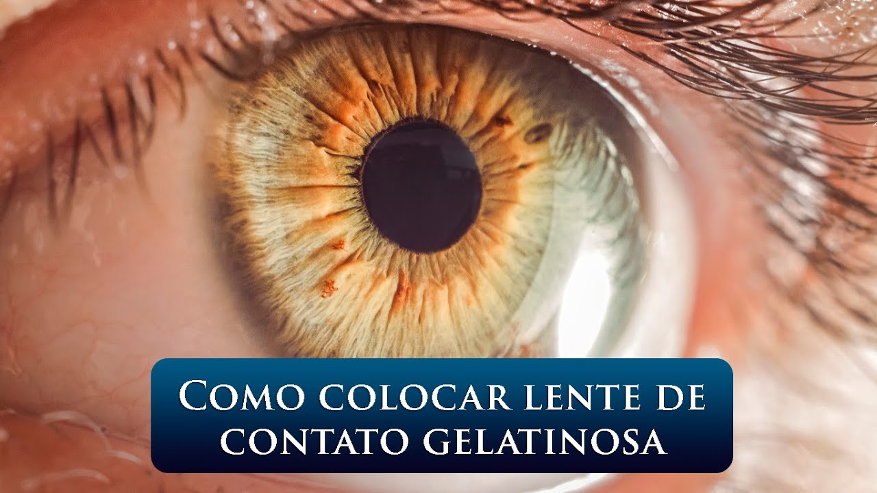 COMO COLOCAR LENTE DE CONTATO GELATINOSA