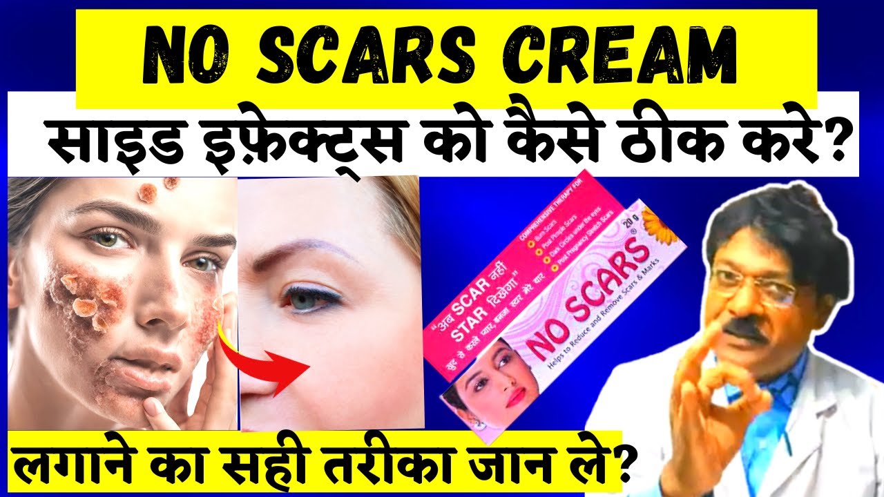 No Scars Cream | no scars cream ke side effects kaise thik kare | no scar cream side effect solution