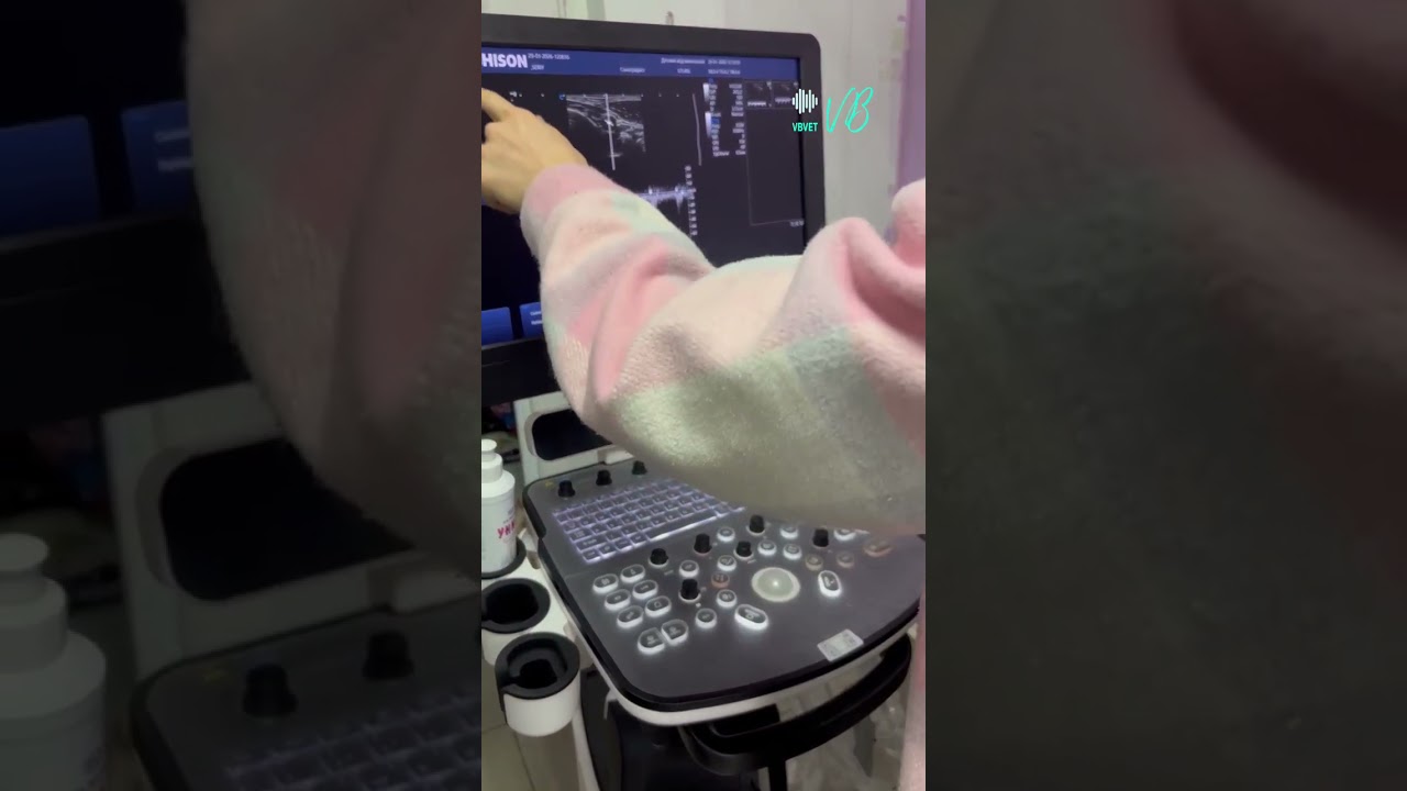 Настройки #ChisonQbit7 #vbvet #мкпоузи 