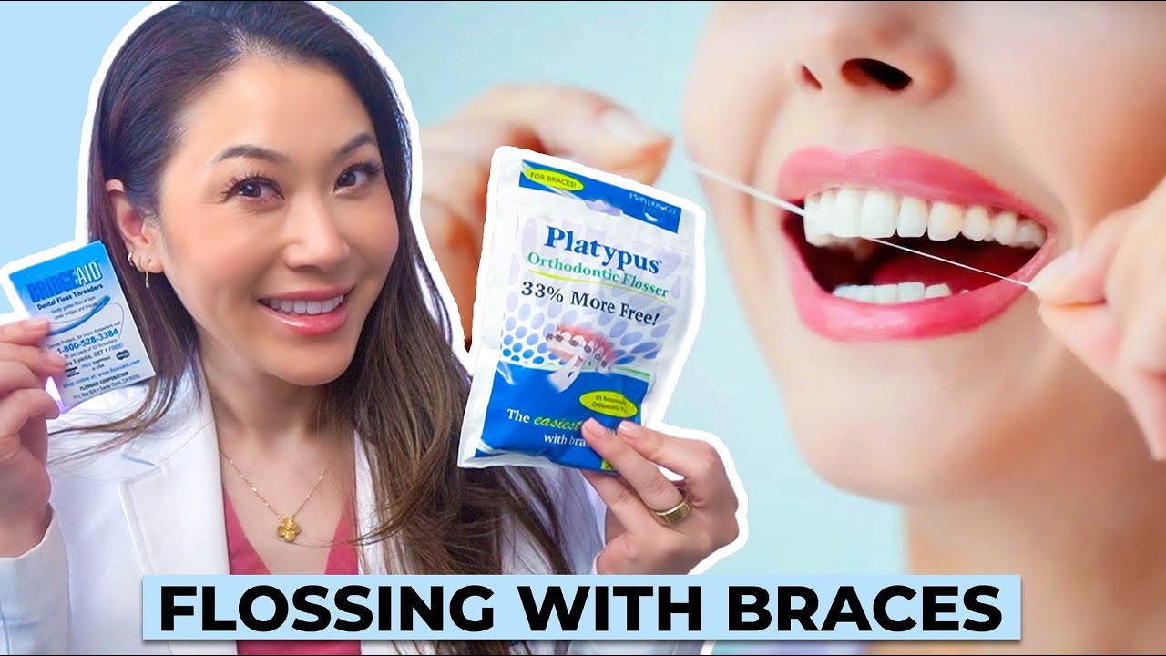 3 Different Ways to Floss with Braces