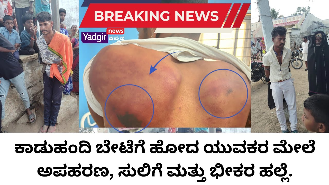 ಯಾದಗಿರಿ || ಗುರುಮಠಕಲ್ ಭಾಗದಲ್ಲಿ ಯುವಕರ ಮೇಲಿನ ಹಲ್ಲೆ – ಕಂಬಕ್ಕೆ ಕಟ್ಟಿ ಕ್ರೂರವಾಗಿ ಥಳನೆ, ಜೀವ ಬೆದರಿಕೆ ಆರೋಪ